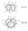Fig. 22 - Body cavity foreign matter capture instrument