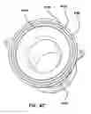 Fig. 09 - Natural orifice surgery system