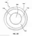 Fig. 11 - Natural orifice surgery system