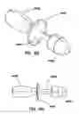 Fig. 13 - Natural orifice surgery system