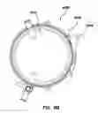 Fig. 26 - Natural orifice surgery system