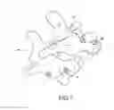 Fig. 02 - Orthopaedic device and methods for its pre-assembly and assembly