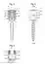 Fig. 03 - Bone anchoring device, tool and method for assembling the same and tool for use with the same