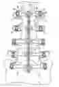 Fig. 01 - Systems for spinal stabilization