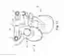 Fig. 11 - Spinal correction adjustment systems and methods