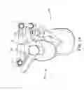 Fig. 13 - Spinal correction adjustment systems and methods