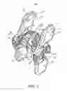 Fig. 02 - Spinous process fixation system and methods thereof
