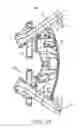 Fig. 12 - Spinous process fixation system and methods thereof