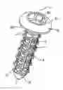Fig. 01 - Bone screw