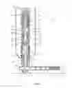 Fig. 03 - Surgical tack delivery system, method and kit
