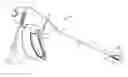 Fig. 01 - Electrosurgical forceps jaw member and seal plate