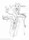 Fig. 02 - Electrosurgical system with suction control, apparatus, system and method