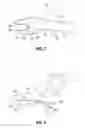 Fig. 03 - Open vessel sealing instrument and method of manufacturing the same