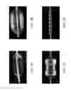 Fig. 02 - Wall thickness compensation during laser orifice drilling