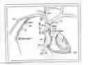 Fig. 01 - Endovascular navigation system and method