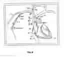 Fig. 05 - Endovascular navigation system and method