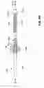 Fig. 13 - Endovascular navigation system and method