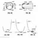 Fig. 15 - Endovascular navigation system and method