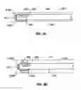 Fig. 17 - Endovascular navigation system and method