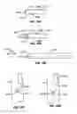 Fig. 20 - Endovascular navigation system and method