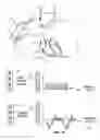 Fig. 35 - Endovascular navigation system and method
