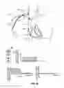 Fig. 37 - Endovascular navigation system and method