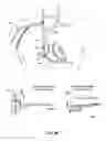 Fig. 41 - Endovascular navigation system and method