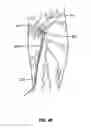 Fig. 49 - Endovascular navigation system and method
