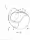 Fig. 06 - DENTAL IMPLANT SCREW AND INSTALLATION TOOLS WITH OFFSET DRIVE ANGLE