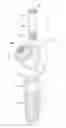 Fig. 01 - Dental implant and abutment system