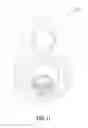 Fig. 14 - Dental implant and abutment system