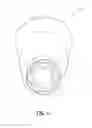 Fig. 15 - Dental implant and abutment system