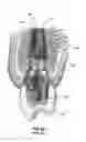 Fig. 03 - Restoration dental implant and method