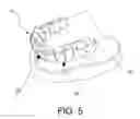 Fig. 05 - Dental implant device
