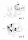 Fig. 07 - Dental implant device
