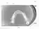 Fig. 01 - Occlusion estimation in dental prosthesis design