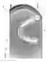 Fig. 02 - Occlusion estimation in dental prosthesis design
