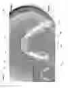 Fig. 03 - Occlusion estimation in dental prosthesis design