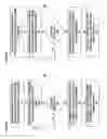Fig. 05 - Occlusion estimation in dental prosthesis design