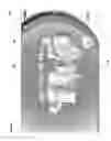 Fig. 06 - Occlusion estimation in dental prosthesis design