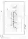 Fig. 13 - Occlusion estimation in dental prosthesis design