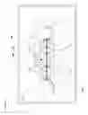 Fig. 16 - Occlusion estimation in dental prosthesis design