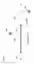 Fig. 18 - Occlusion estimation in dental prosthesis design