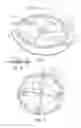 Fig. 02 - Prosthesis for repairing a hernia defect