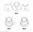 Fig. 08 - Nonaugmentive mastopexy