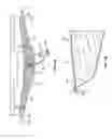 Fig. 02 - Methods of using delivery systems for the placement of surgical implants