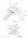 Fig. 22 - Methods of using delivery systems for the placement of surgical implants
