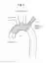Fig. 07 - High Flow Embolic Protection Device