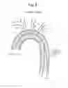 Fig. 09 - High Flow Embolic Protection Device