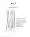 Fig. 13 - High Flow Embolic Protection Device